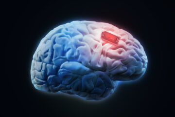 Human brain implant
