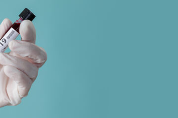 Coronavirus test sample